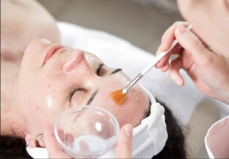Dùng kem trộn, peel quá mức hoặc bỏ chống nắng là những sai lầm có thể khiến tình trạng nám khó kiểm soát hơn